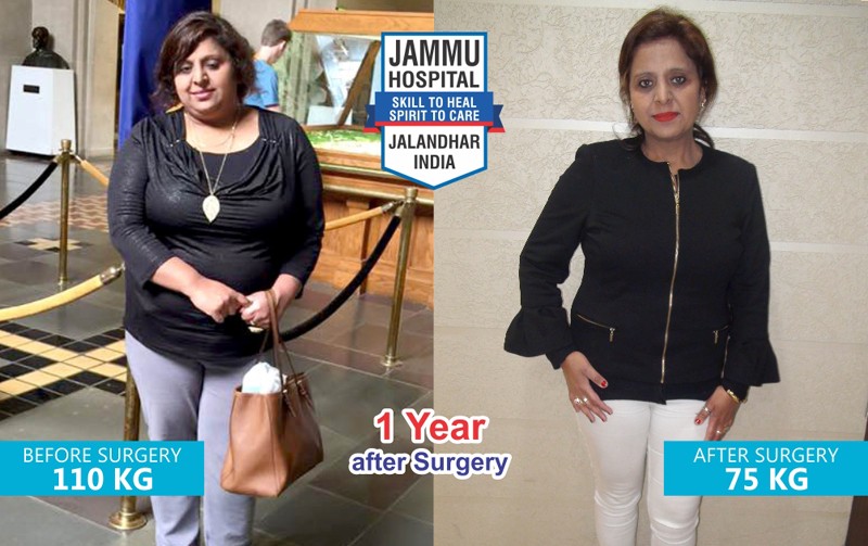 Best Bariatric Surgeon in Punjab – Dr GS Jammu