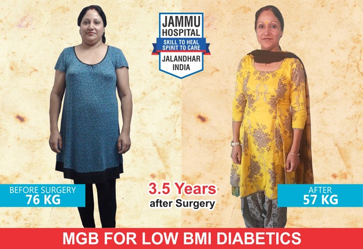 Best Bariatric Surgeon in Punjab – Dr GS Jammu